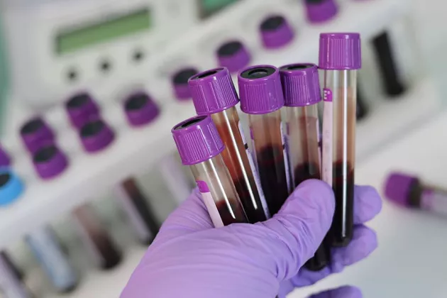 Test tubes in a hand. Photo. 