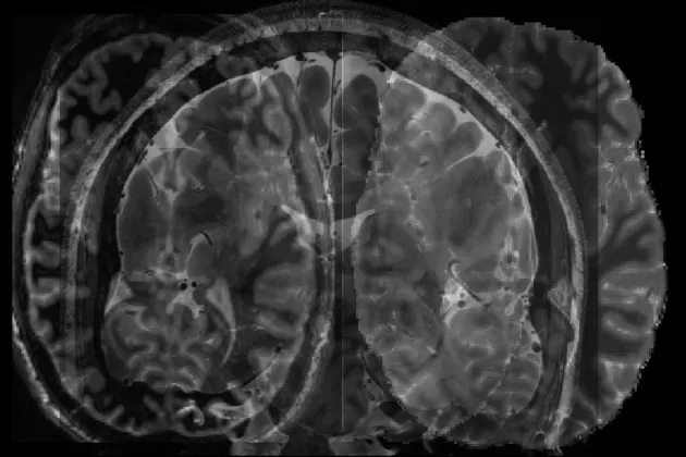 Brain scan. Photo. 