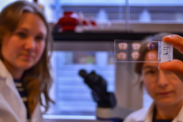 Glass slide with brain sections in front of two vague persons. Photo.