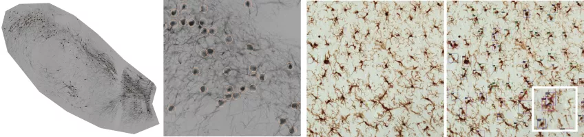Photograph of rat substantia nigra analyzed with our ML algorithm for the detection of DAB immunolabeled cells (TH).